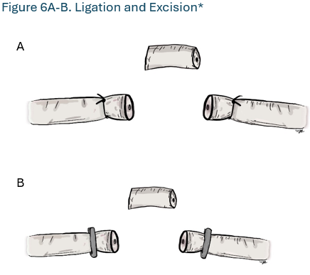 Figure 6A-B. Ligation and Excision Figure 6A-B. Ligation and Excision