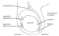 Figure 5. Illustration of the common appendices of the testis and epididymis. The appendix testis is most commonly affected by