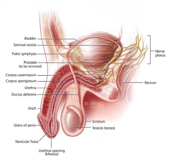 prostate cancer american urological association roșeață în prostatită