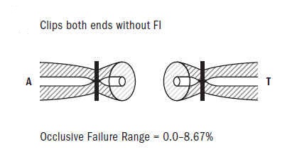 Figure 8: Clip Both ends without FI