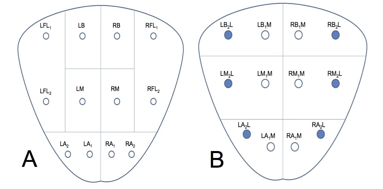 prostate biopsy cores