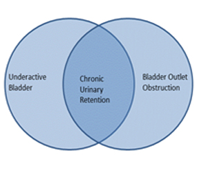 Chronic Urinary Retention Figure 1